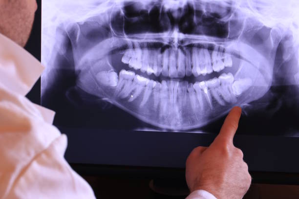  St Gabriel, LA Emergency Dentist Pros
